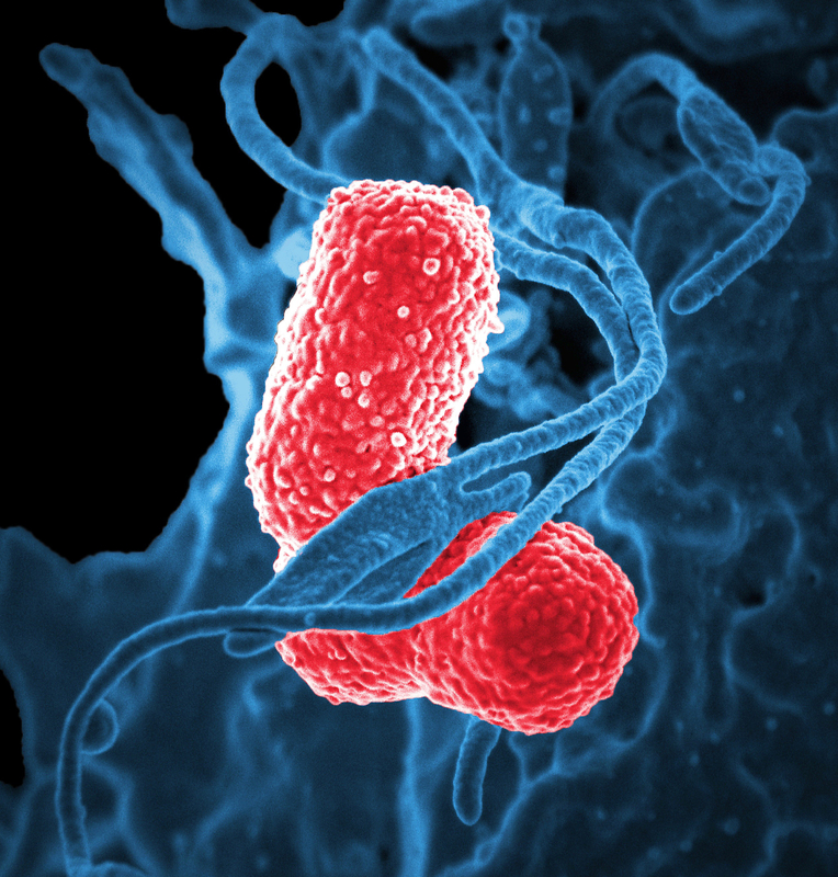 <p>Bacteria viewed through a microscope.</p>
