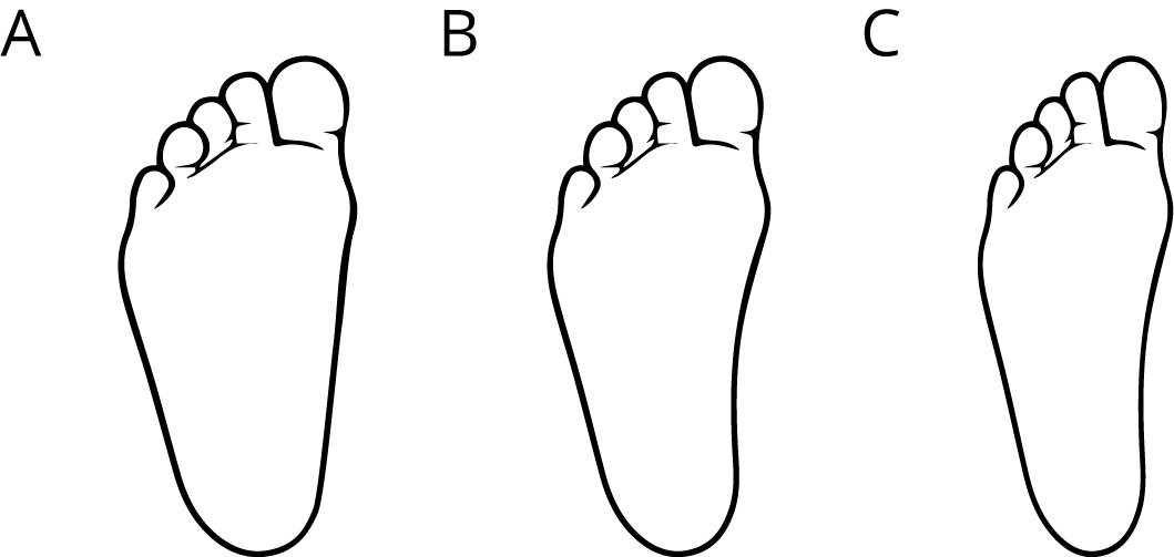 <p>Images of 3 different drawn feet.</p>
